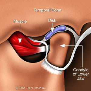 TMJ Joint.